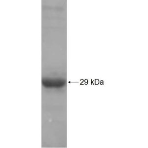 Recombinant Human AIFM3 protein, His-tagged