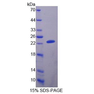 Recombinant Cattle A1BG protein, His & T7-tagged