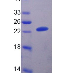 Recombinant Cattle A1BG protein, His & T7-tagged
