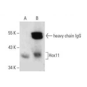 Hox11 (1D7) HRP