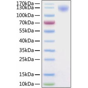 2019-nCoV Spike S1 Protein (His-Tag)