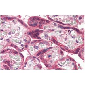 HRP Anti-6X His tag® antibody(AB1187)