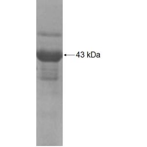 Recombinant Human AFF4 protein, His-tagged
