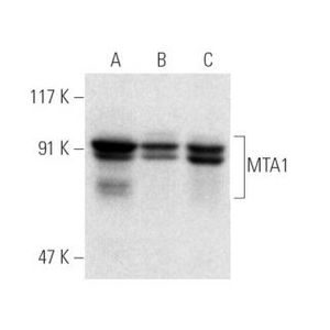 MTA1 (A-11) FITC