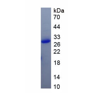 Recombinant Mouse A1cf Protein, His-tagged