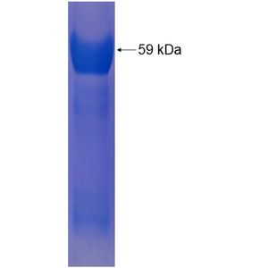 Recombinant Human AKR1C4 protein, GST-tagged