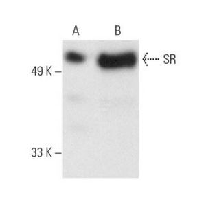SR (1H4) Alexa Fluor® 594