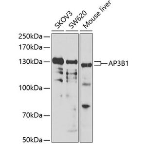 Anti-AP3B1 antibody