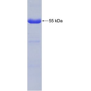 Recombinant Human AMFR protein, His-tagged