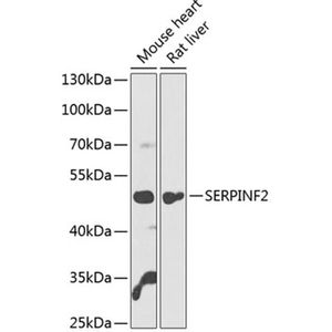Anti-SERPINF2 antibody