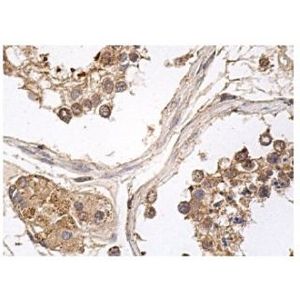 NIK (A-12) Alexa Fluor® 594