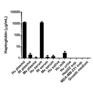Anti-Cytokeratin 7 antibody [EPR17078] - Cytoskeleton Marker(AB181598)