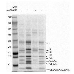 Anti-Influenza B Virus Nucleoprotein antibody [B017](AB20711)