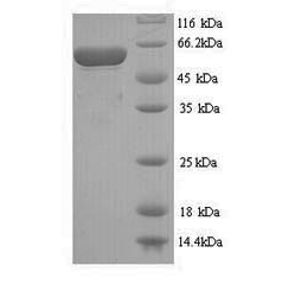 Iron Stain Kit (Prussian Blue Stain)(AB150674)