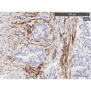 Anti-Fibroblast activation protein, alpha antibody [EPR20021]