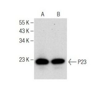 P23 (B-5) | Science Company | Labroots