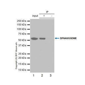 Anti-DFNA5/GSDME antibody [EPR19859] - N-terminal