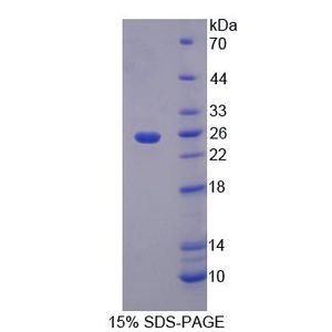 Recombinant Human A1BG protein, His-tagged