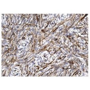 Filamin 1 (E-3) Alexa Fluor® 594