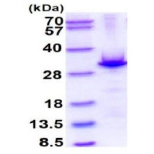 Anti-TAGLN/Transgelin antibody(AB14106)
