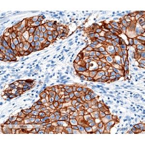 Anti-ErbB2 / HER2 antibody [SP3]