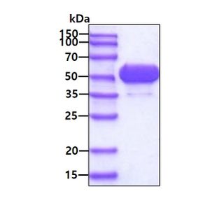 Active Recombinant Human ALDH1A1 Protein