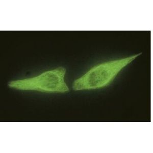 Cytokeratin 7/17 (C46)