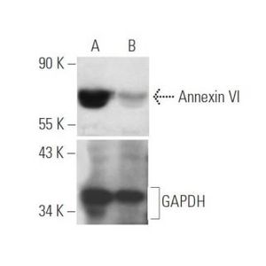 Annexin VI siRNA (h)