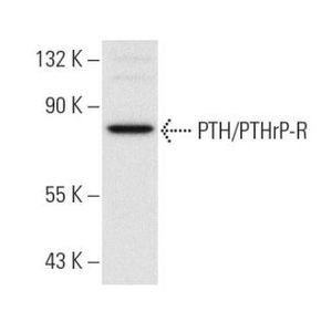 PTH/PTHrP-R (3D1.1) PE