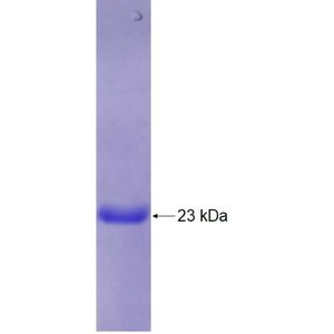 Recombinant Human ALG13 protein, His-tagged