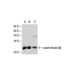 casein kinase IIβ (6D5) Alexa Fluor® 546