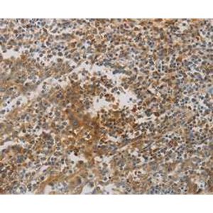 Human Albumin ELISA Kit(AB179887)