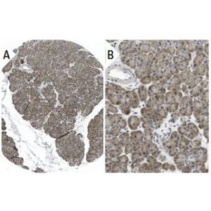 PP2A-Aα/β (4G7) AC