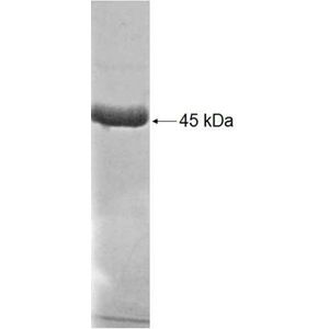 Recombinant Human ADPRHL2 protein, His-tagged