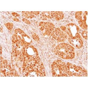 Alexa Fluor® 647 Anti-Glucose Transporter GLUT1 antibody [EPR3915](AB195020)