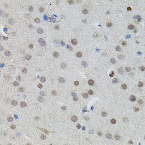 Anti-MYCN antibody