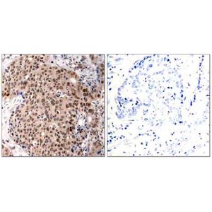 Anti-Ras (mutated Q61R) antibody [SP174](AB227658)