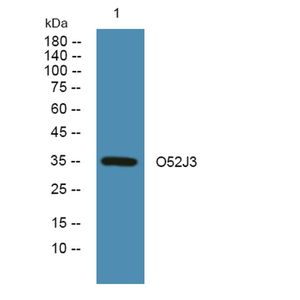 Anti-O52J3 antibody