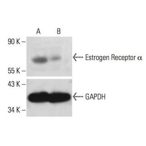 Estrogen Receptor alpha siRNA (h)