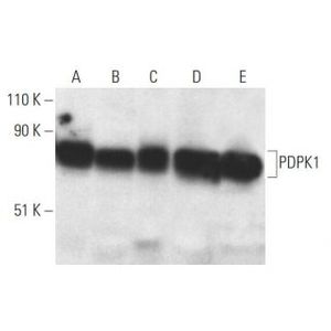 PDPK1 (A-10)
