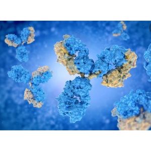 Anti-SMARCA5 antibody