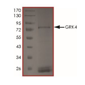 Anti-NeuN antibody [EPR12763] - Rat IgG2a (Chimeric)(AB279297)