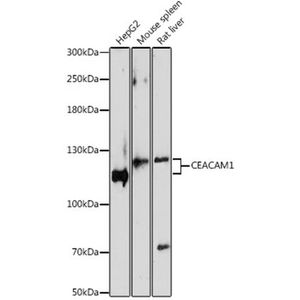 Anti-CEACAM1 antibody