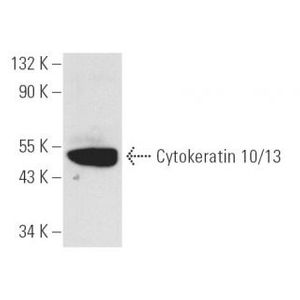 Cytokeratin 10/13 (DE-K13)