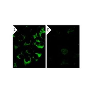 casein kinase Iα siRNA (h)