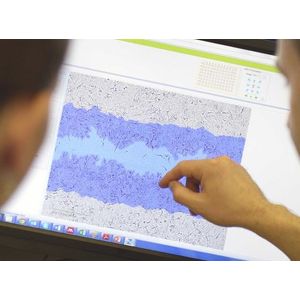 Incucyte® Scratch Wound Cell Invasion & Migration Software