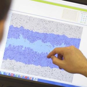 Incucyte® Scratch Wound Cell Invasion & Migration Software