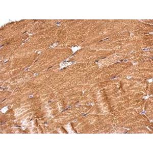 Human IFN gamma ELISA Kit(AB174443)