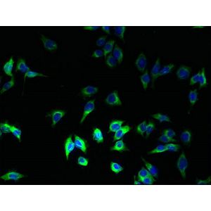 Anti-Insulin antibody [EPR17359](AB181547)