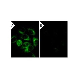 α Tubulin siRNA (h)